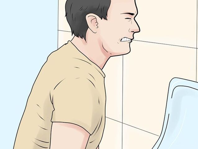 Prostatitis painful urination